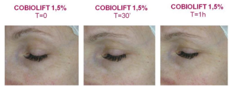 Cobiolift